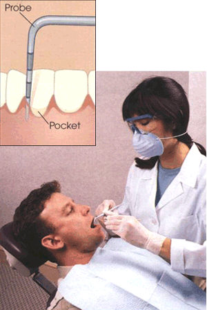 http://thebrooklyndentist.com/wp-content/uploads/2012/10/scaling-3.gif