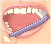 http://thebrooklyndentist.com/wp-content/uploads/2012/10/scaling-6.gif