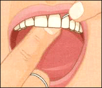 http://thebrooklyndentist.com/wp-content/uploads/2012/10/scaling-7.gif